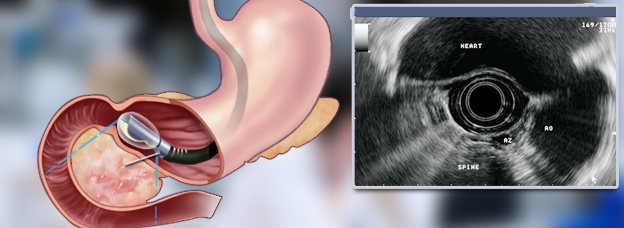 اولین دستگاه آندوسونوگرافی استان وارد مرکز درمانی امیرالمومنین (ع) شد